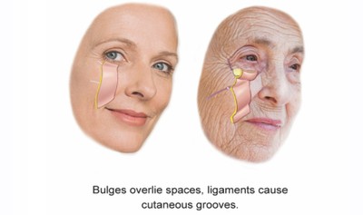 Face fourth layers